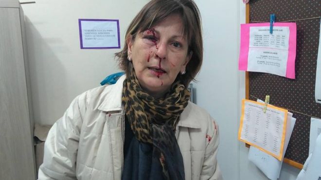Professora agredida por aluno denuncia mensagens de ódio: ‘Já atingiram meu olho, mas não vão me calar’